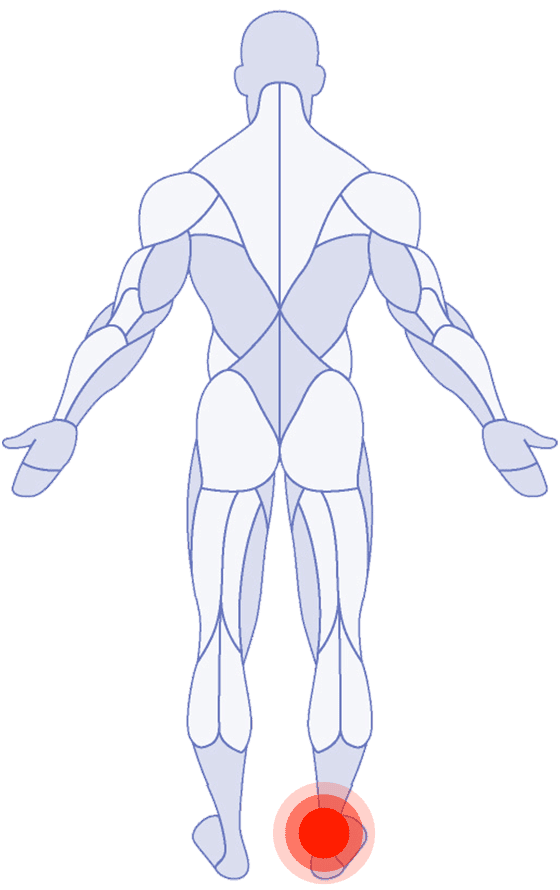 Ankle Pain