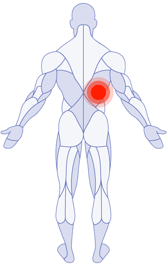 Back Pain