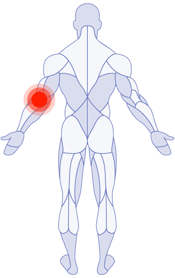 Elbow Pain