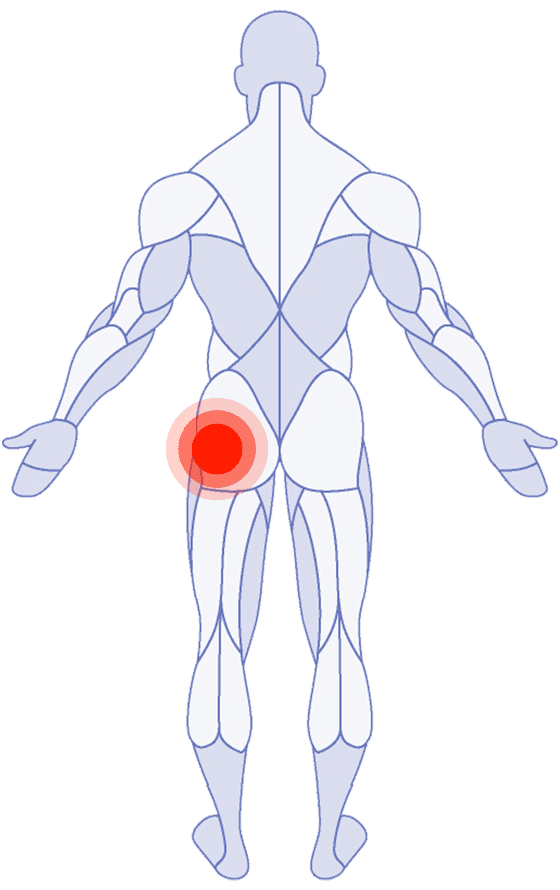 Hip Pain
