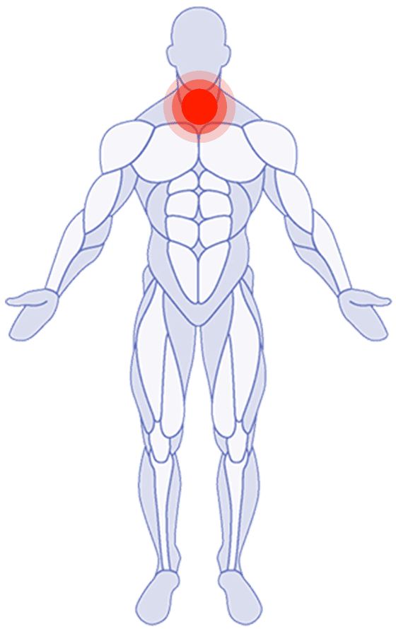 Neck Pain