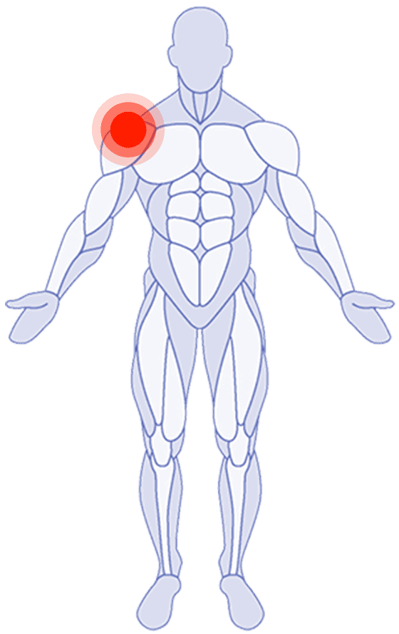 Shoulder Pain